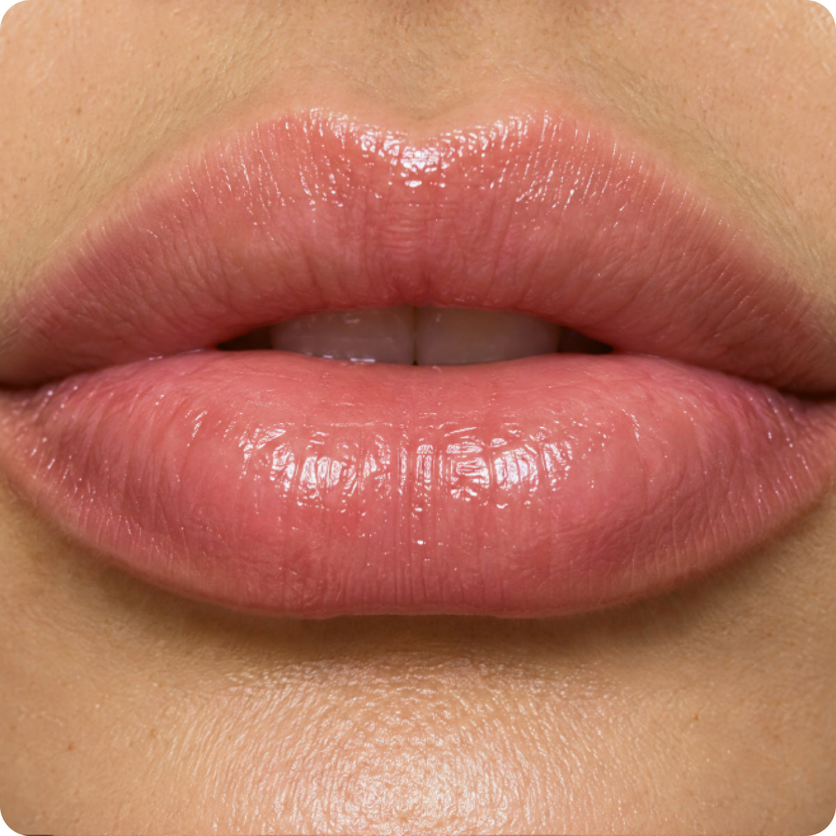 Lips after using the lip balm