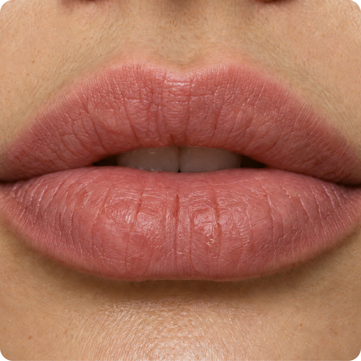 Lips before using the lip balm